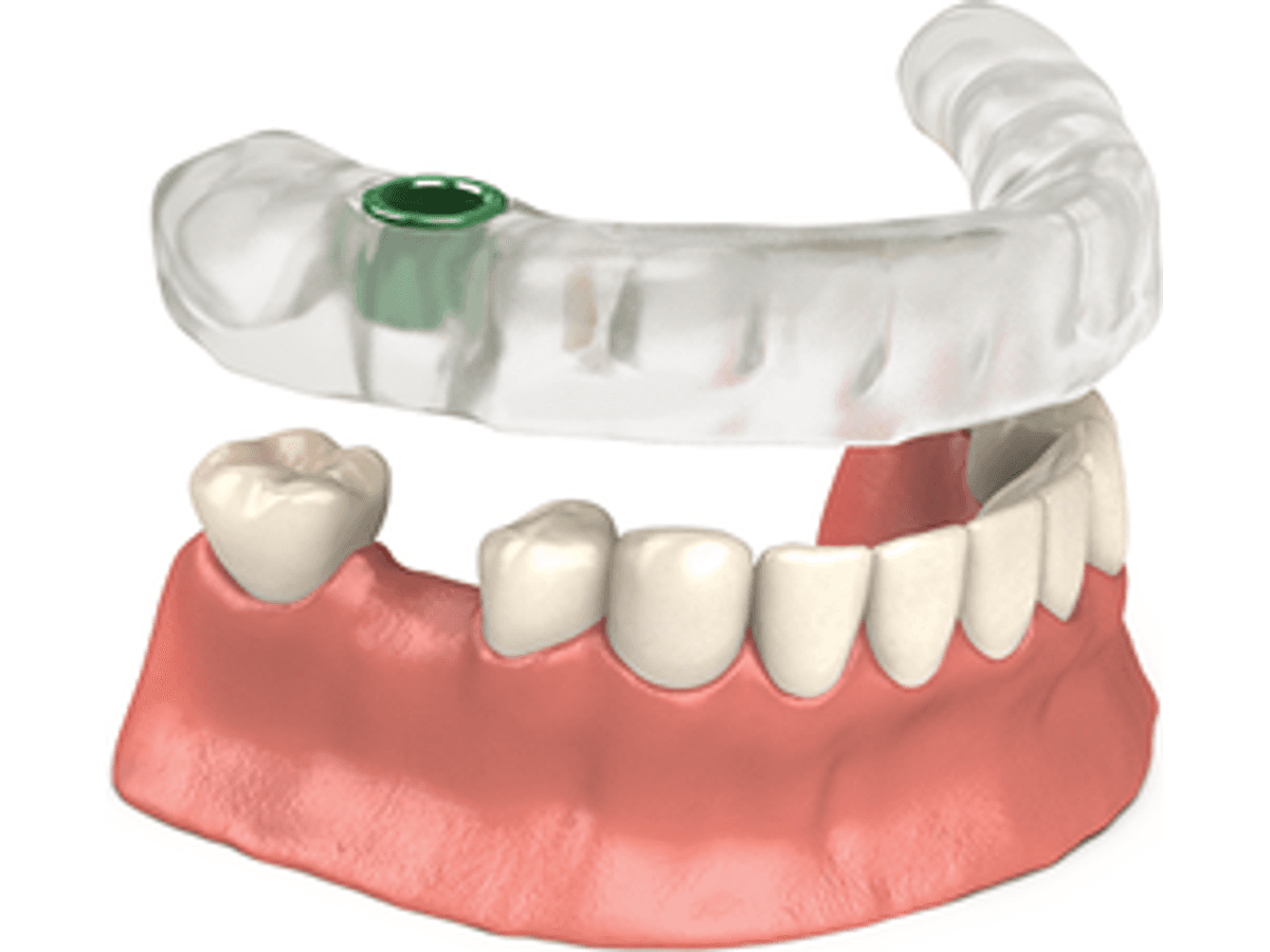 Implant Surgical Guide — product shot