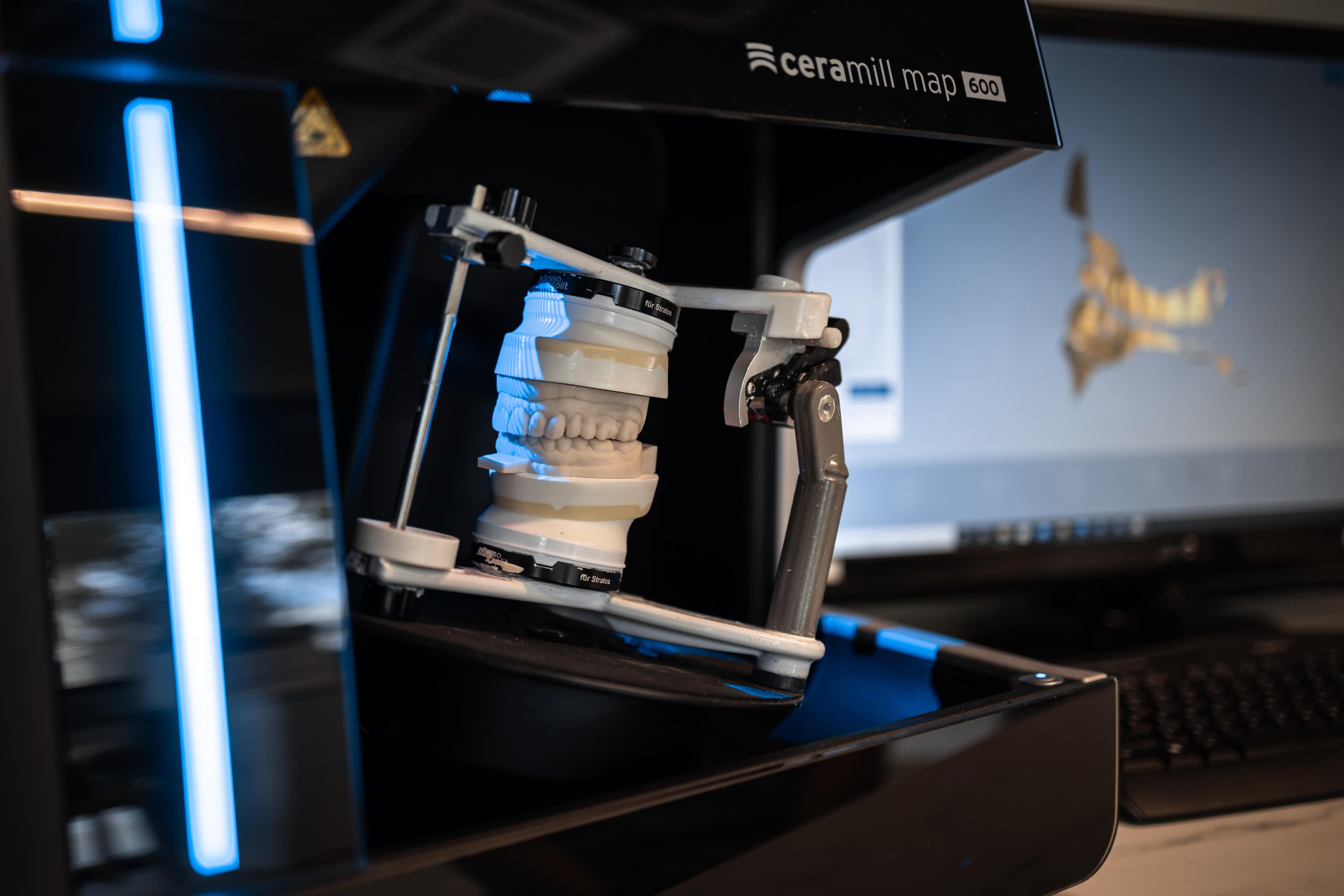 Ceramill Map 600 сканнер дээр шүдний загварыг уншиж буй лабораторийн ажиллагаа