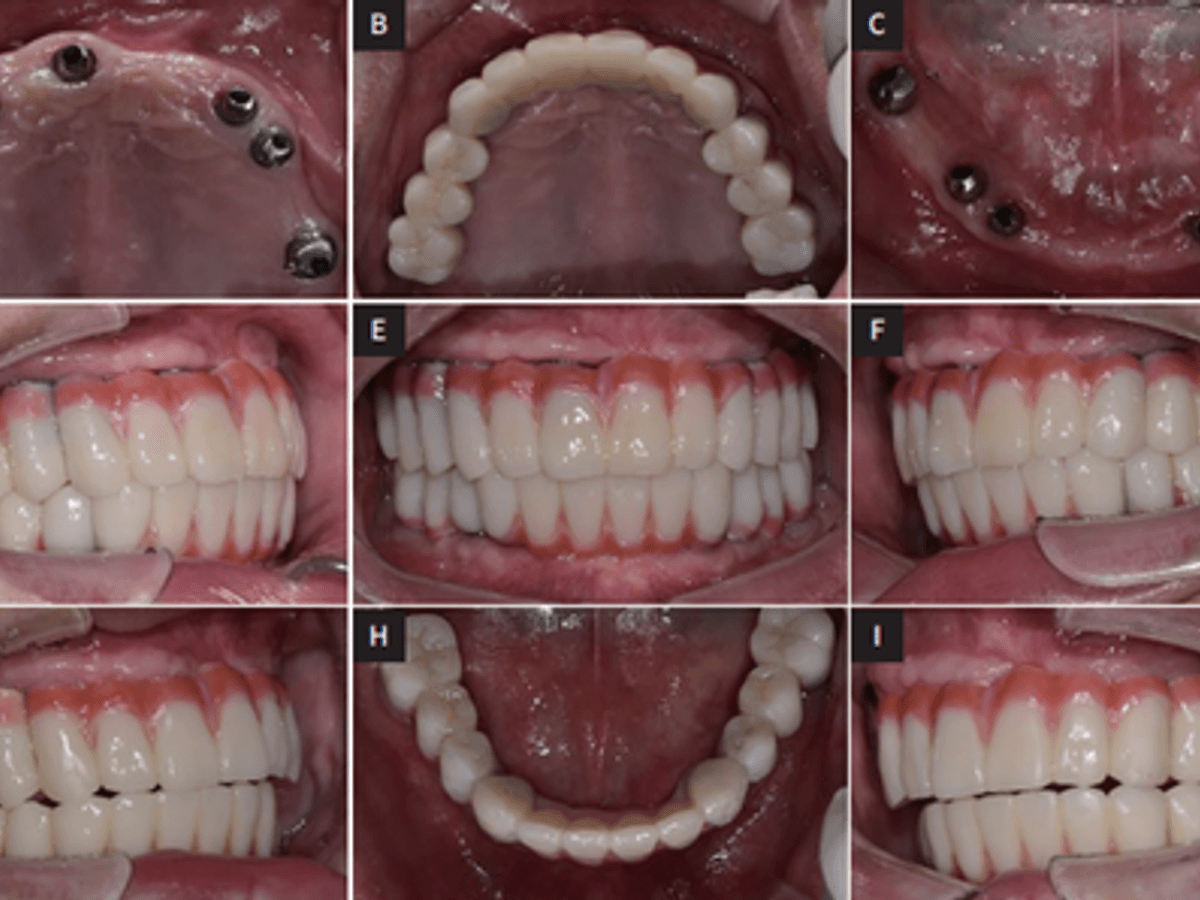 All on X — image 2